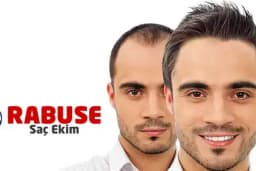 Rabuse Saç Ekim