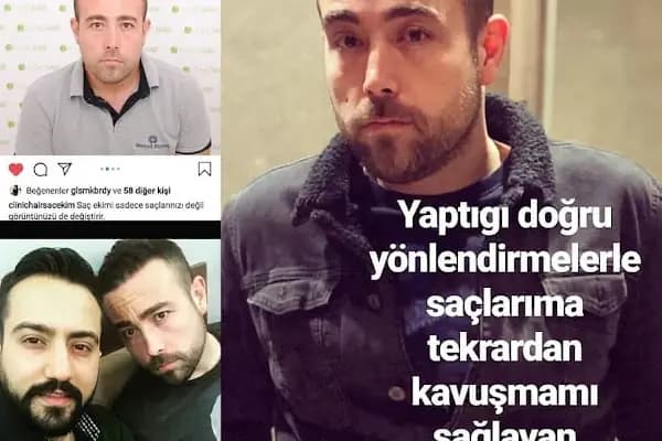 Clinichair Saç Ekim Merkezi - Saç Transplantasyonu Kliniği - İzmir Bergama