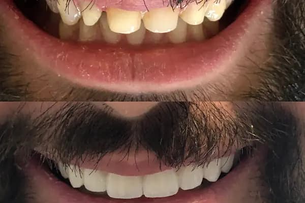 Özel Bursa Uzmanlar Ağız ve Diş Sağlığı - Diş Kliniği - Bursa Osmangazi