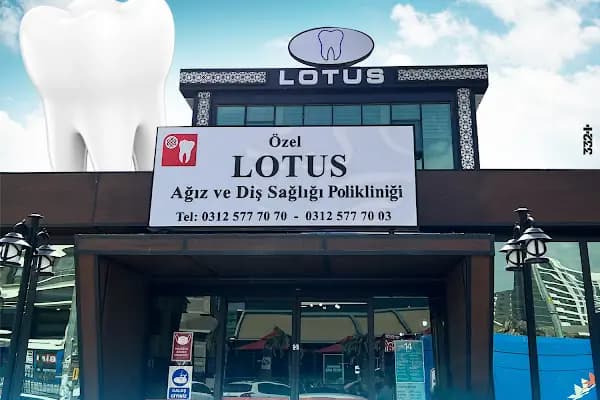 Lotus Ağız ve Diş Sağlığı Polikliniği - Diş Kliniği - Ankara Etimesgut