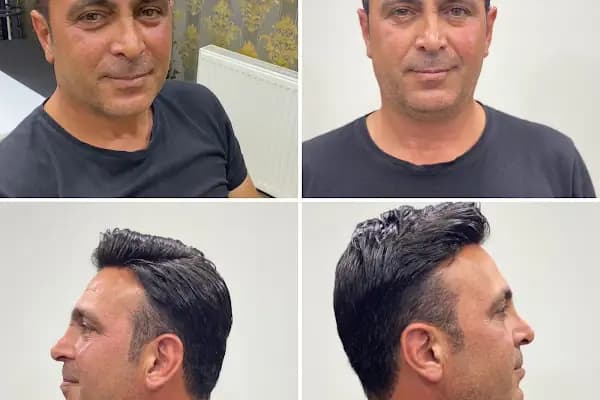 Bulut Protez Saç Merkezi - Saç Yenileme Hizmeti - İstanbul Küçükçekmece