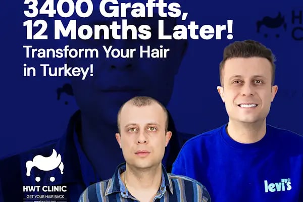 HWT Clinic - Hair Transplant Turkey - Resim 1