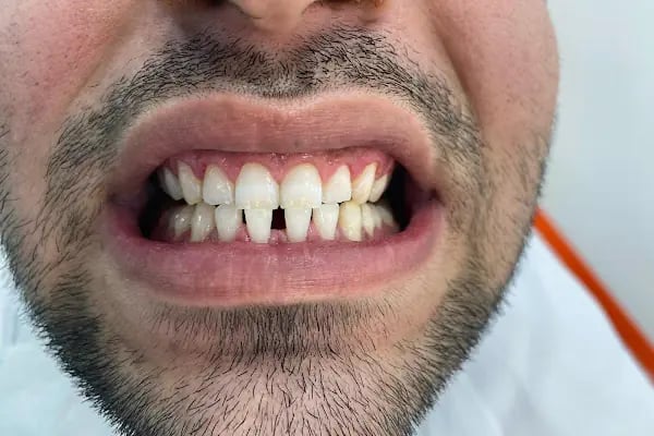 Özel Avrupadent Çiğli Ağız ve Diş Sağlığı Polikliniği - Resim 4