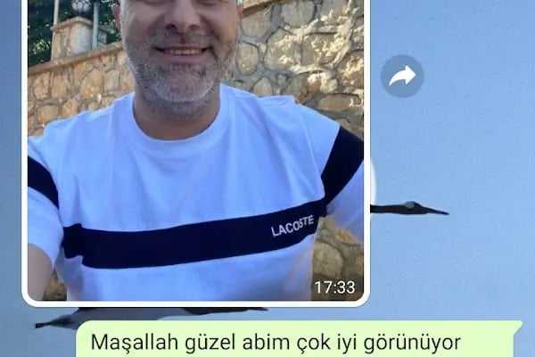 SU HASTANESİ /Saç Ekim - Resim 8