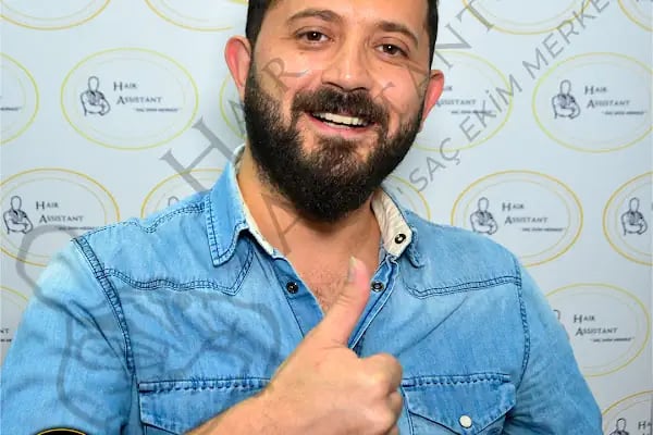 HASAN DEMİR SAÇ EKİMİ ANKARA - Resim 16