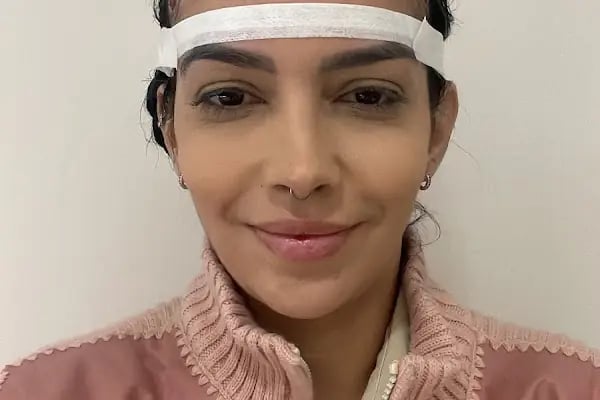 Henfa Clinic - Hair Transplant - Resim 10