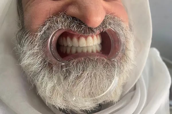 Diş Hekimi Mehmet Serkan Baykuş - Resim 2