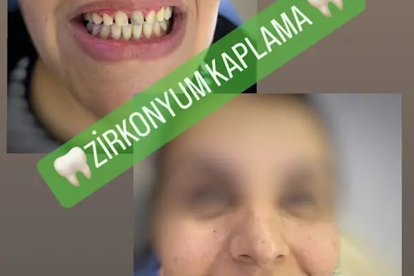 Diş Hekimi Mehmet Serkan Baykuş - Resim 7