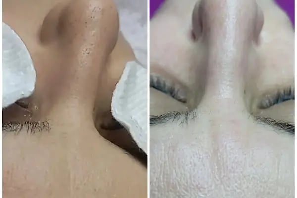 Siyam güzellik salonu - Resim 7