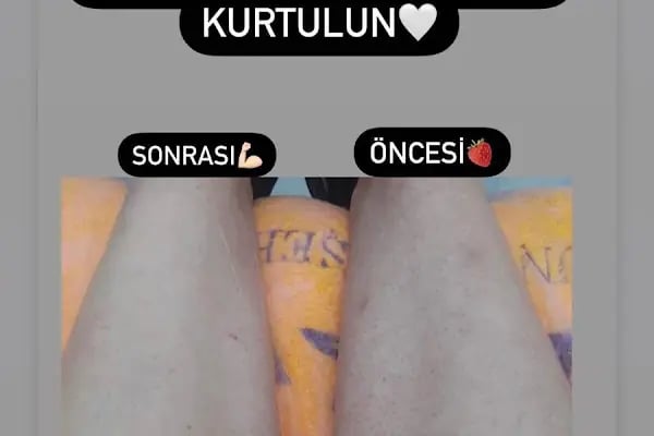 Zeynep Koçer Estetik&amp;Güzellik Merkezi - Resim 6
