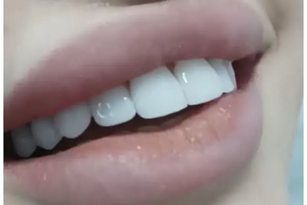 Özel Hesna Ağız ve Diş Sağlığı Polikliniği - Resim 8