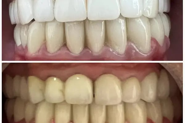 Dentist Alanya , Diş Hekimi Umut ERGÜN - Resim 13
