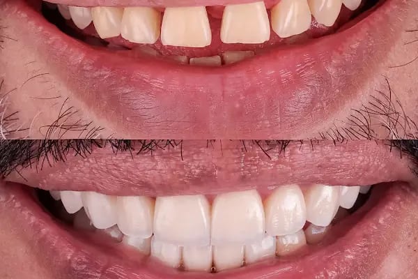 Dentist Alanya , Diş Hekimi Umut ERGÜN - Resim 8