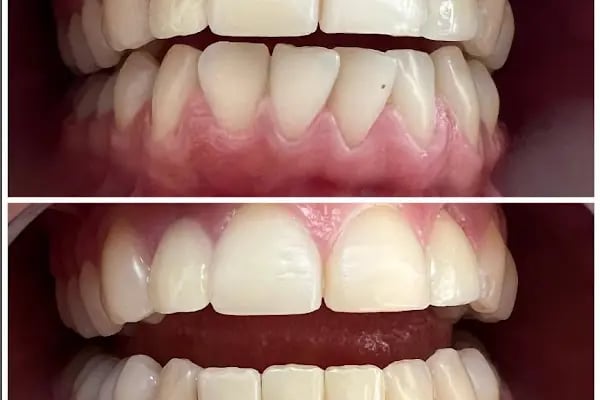 Dentist Alanya , Diş Hekimi Umut ERGÜN - Resim 11