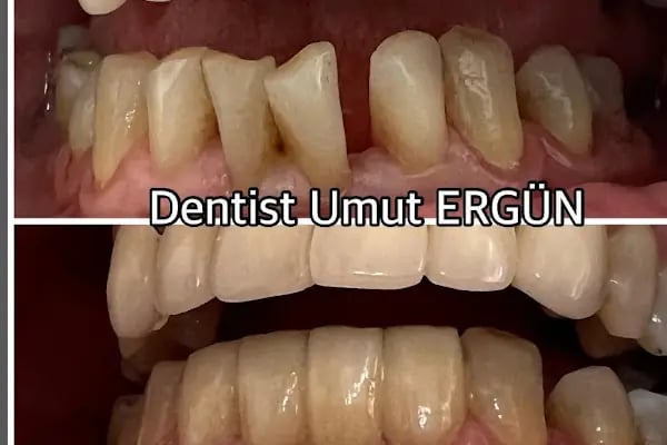 Dentist Alanya , Diş Hekimi Umut ERGÜN - Resim 2