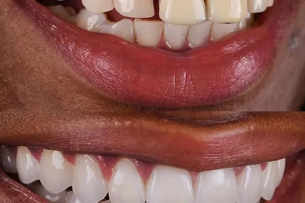 Dentist Alanya , Diş Hekimi Umut ERGÜN - Resim 5