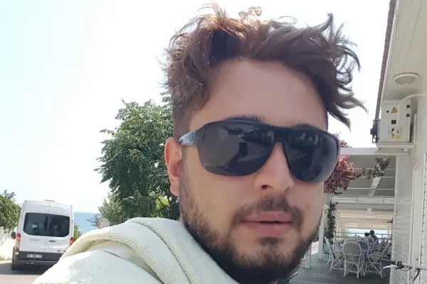 Gaziantep Protez Saç - Resim 14