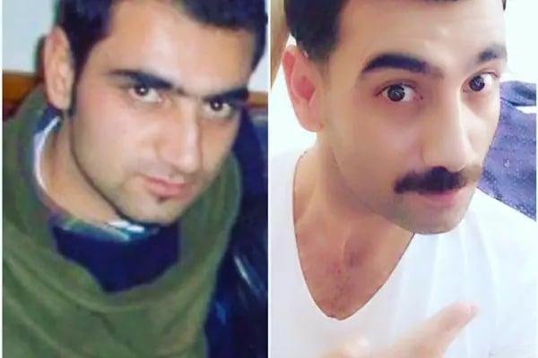 Gaziantep Protez Saç - Resim 10