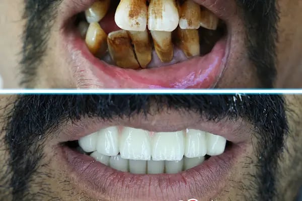 Özel Yiğit Ağız ve Diş Sağlığı Polikliniği - Resim 16