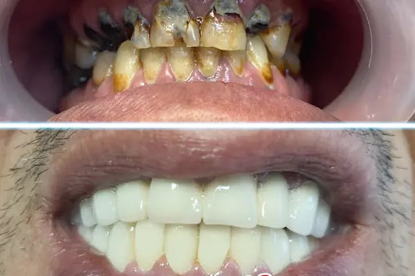 Özel Yiğit Ağız ve Diş Sağlığı Polikliniği - Resim 17