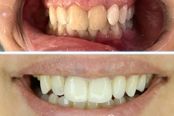 Özel Yiğit Ağız ve Diş Sağlığı Polikliniği - Resim 18