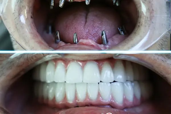 Özel Yiğit Ağız ve Diş Sağlığı Polikliniği - Resim 19