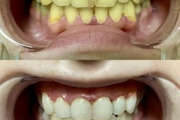 BAĞCILAR ÖZEL AİLE TIP MERKEZİ DİŞ KLİNİĞİ - Resim 8
