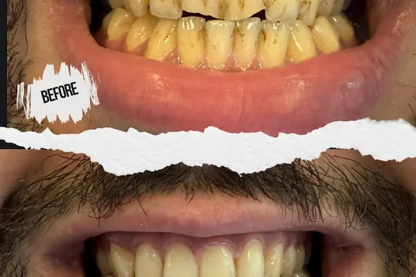 BAĞCILAR ÖZEL AİLE TIP MERKEZİ DİŞ KLİNİĞİ - Resim 12