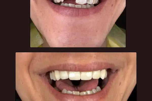 BAĞCILAR ÖZEL AİLE TIP MERKEZİ DİŞ KLİNİĞİ - Resim 13