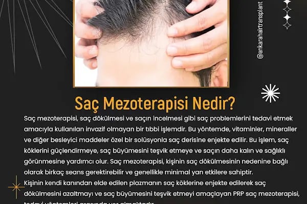 Ankara Saç Ekimi Sinem Ayseli - Resim 1