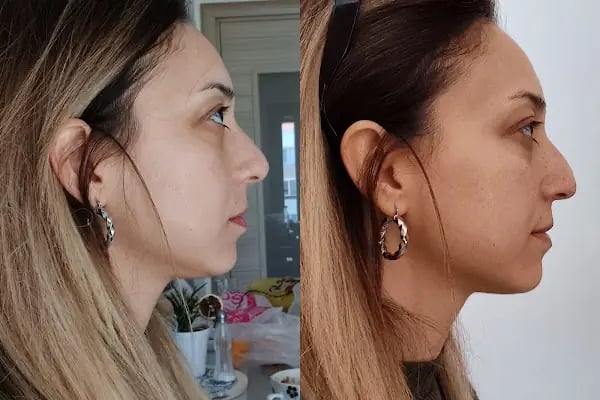 Emma Beauty Center Bornova - Resim 6