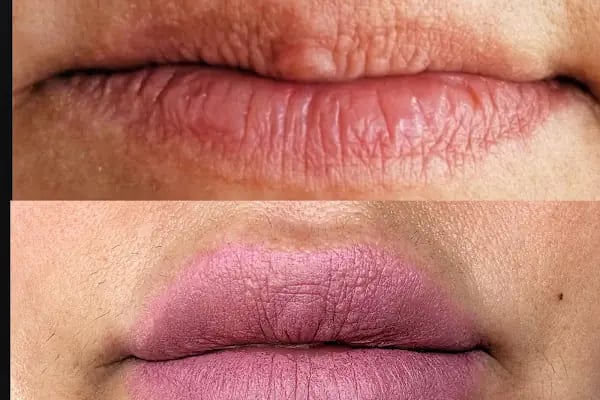 Emma Beauty Center Bornova - Resim 10