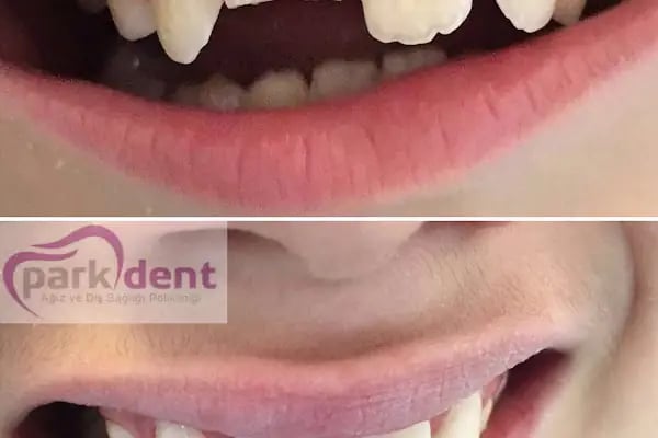 Özel Parkdent Ağız ve Diş Sağlığı Polikliniği - Resim 5