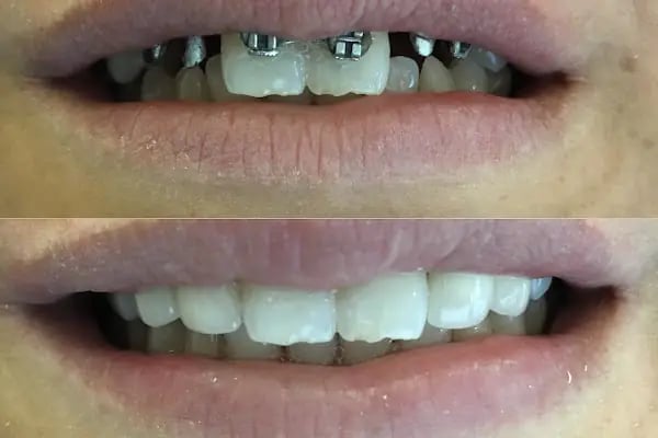 Özel Parkdent Ağız ve Diş Sağlığı Polikliniği - Resim 3