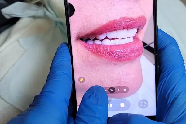 Özel Dent ON6 Ağız ve Diş Sağlığı Polikliniği - Resim 11