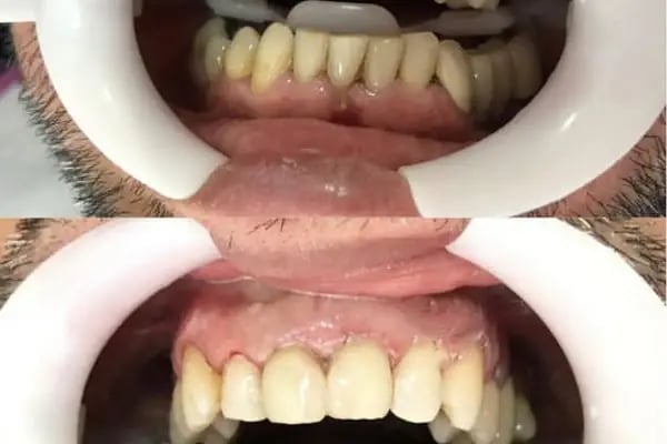 Özel Anadolu Ağız ve Diş Sağlığı Polikliniği - Resim 13