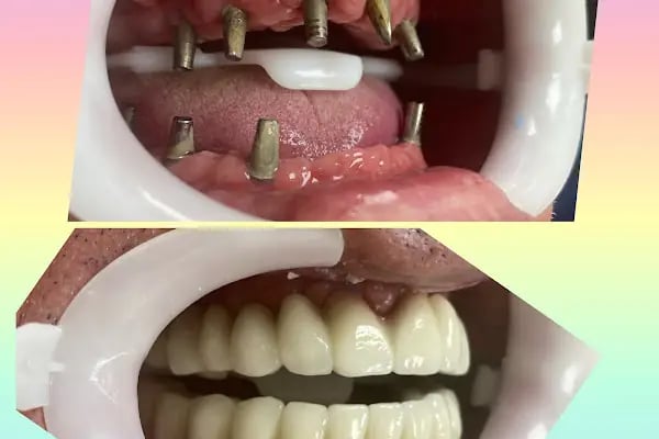 Özel Anadolu Ağız ve Diş Sağlığı Polikliniği - Resim 16