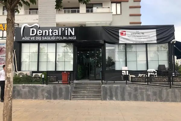 Özel Dentalin Ağız Ve Diş Sağlığı Merkezi - Resim 6
