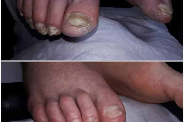 Protez tırnak kalici makyaj diyot lazer aliaga saloon meltem - Resim 9