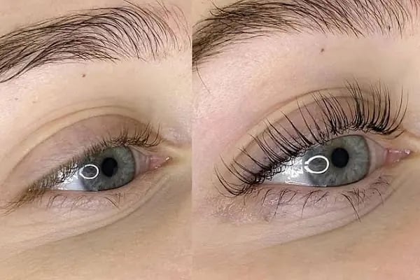 TT BEAUTY CENTER - Resim 5