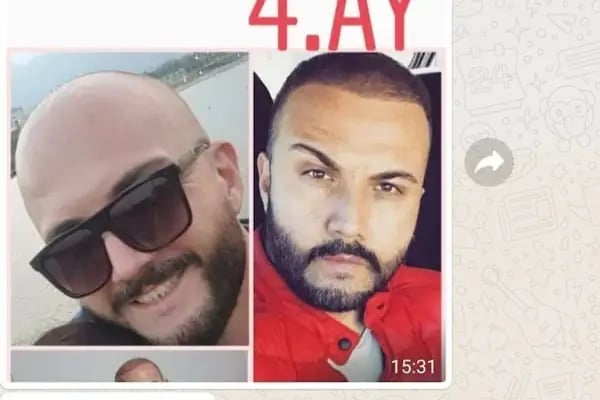 ESTETİK HAİR SAÇ EKİMİ - Resim 20