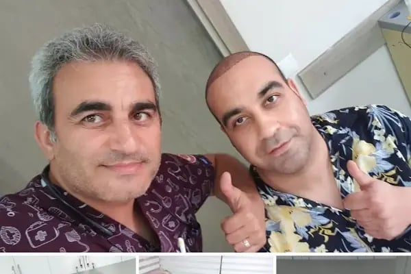 ESTETİK HAİR SAÇ EKİMİ - Resim 16