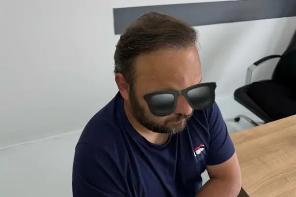 İbrahim Erayhan-Saç Ekimi-Bursa Tıp Merkezi - Hairtransplant Clinic - Resim 15