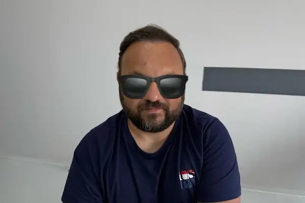 İbrahim Erayhan-Saç Ekimi-Bursa Tıp Merkezi - Hairtransplant Clinic - Resim 6