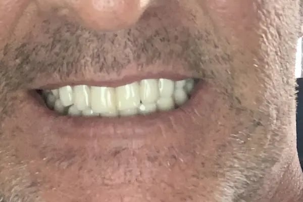 Özel Koza Ağız ve Diş Sağlığı Polikliniği - Resim 6