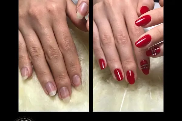 Buz Lazer Epilasyon Merkezi Kudret Ayyıldız | Bağlıca | Ümitköy |Lazer Epilasyon | Kalıcı Makyaj | Microblading | Cilt Bakımı - Resim 7