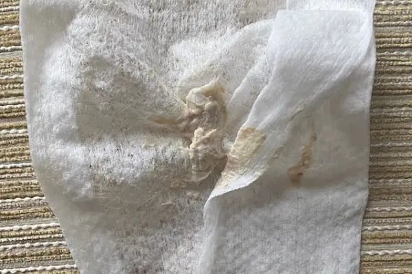 Keçiören Patiska Veteriner Kliniği - Resim 17