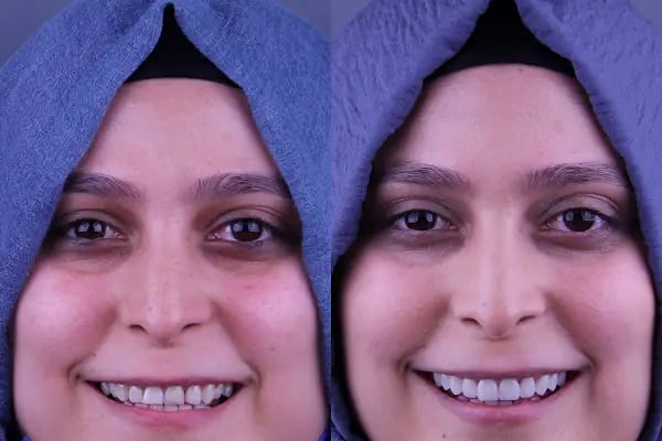 Dentium Selçuklu - Konya, Diş Hekimi, İmplant, Zirkonyum, Gülüş Tasarımı, Estetik, Ortodonti, Çocuk, Gece Açık Dişçi, Acil - Resim 9
