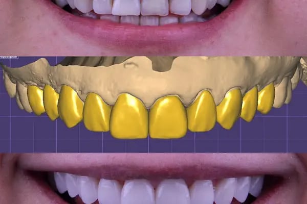 Dentium Selçuklu - Konya, Diş Hekimi, İmplant, Zirkonyum, Gülüş Tasarımı, Estetik, Ortodonti, Çocuk, Gece Açık Dişçi, Acil - Resim 7