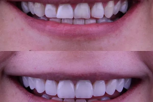 Dentium Selçuklu - Konya, Diş Hekimi, İmplant, Zirkonyum, Gülüş Tasarımı, Estetik, Ortodonti, Çocuk, Gece Açık Dişçi, Acil - Resim 11